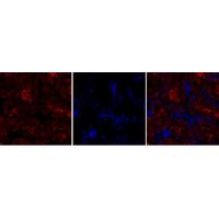 GSK3B antibody