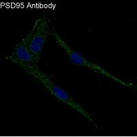 PSD95 Rabbit mAb