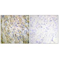 PSA Polyclonal Antibody