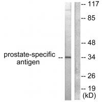 PSA Polyclonal Antibody