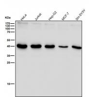 PGK1 Rabbit mAb