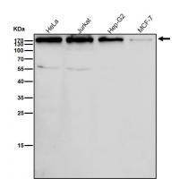 HDAC9 Rabbit mAb