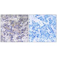 Ribosomal Protein S21 Polyclonal Antibody