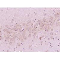 MARCKS (Phospho-Ser152 + Ser156) Antibody HRP Conjugated