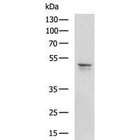 KISS1R Antibody