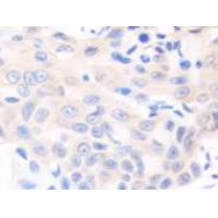 SOCS6 Antibody