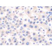 SOCS6 Antibody