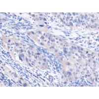 CHRDL2 Antibody