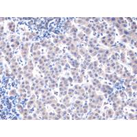 CHRDL2 Antibody