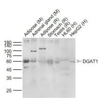 DGAT1 Antibody