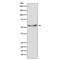 ATP5A1 Rabbit mAb