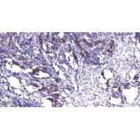 LATS1/2 (Phospho-Ser909/872) Antibody