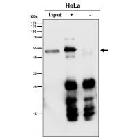 P2Y12 Rabbit mAb