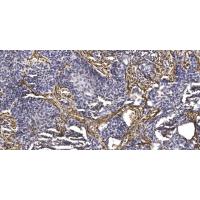 MCPH1 Antibody