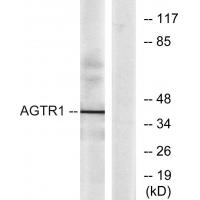 AGTR1 Antibody