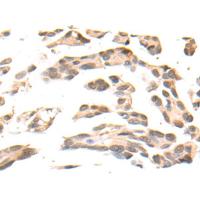 TAB1 Antibody