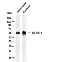 GPER1 Rabbit mAb