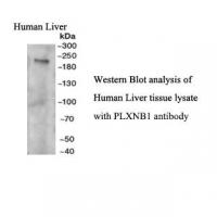 Plexin B1 Antibody