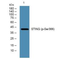 STING  (Phospho-Ser366) Antibody