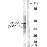 KOR-1 (Phospho-Ser369) Polyclonal Antibody