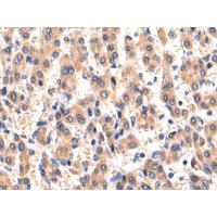 WDR6 Antibody