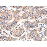 WDR6 Antibody