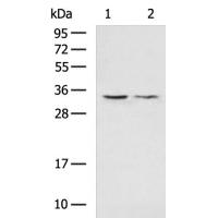 VDAC3 Antibody