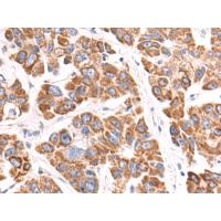 VDAC3 Antibody