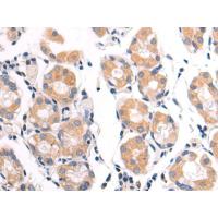 VDAC3 Antibody