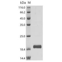 Recombinant Human C-C motif chemokine 8(CCL8) 