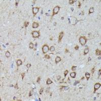 LGR5 Rabbit Polyclonal Antibody