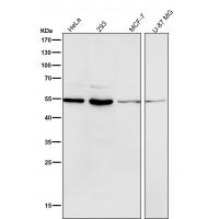 MiTF Rabbit mAb