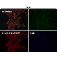 MiTF Rabbit mAb