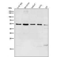 MiTF Rabbit mAb