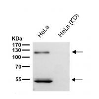 ORP1 Rabbit mAb