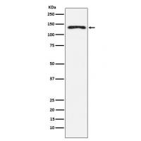 NEDD4 Rabbit mAb