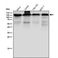 NEDD4 Rabbit mAb