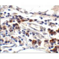 TFF3 Antibody