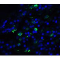 TFF3 Antibody