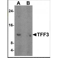 TFF3 Antibody