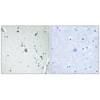 CYP2E1 Polyclonal Antibody