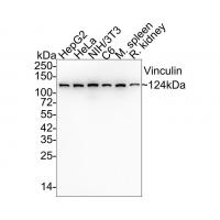 Vinculin Rabbit mAb