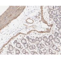 Vinculin Rabbit mAb