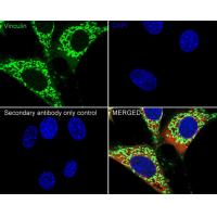 Vinculin Rabbit mAb