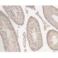 Vinculin Rabbit mAb