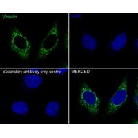 Vinculin Rabbit mAb