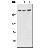 ATXN2 Polyclonal Antibody