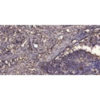 SHOX2 Polyclonal Antibody