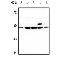 G3BP2 Rabbit Polyclonal Antibody