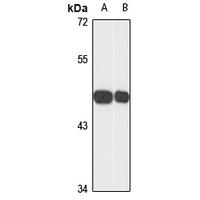 TIAL1 Rabbit Polyclonal Antibody